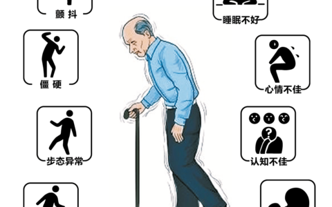 帕金森病的新曙光：单克隆抗体治疗引领革命性突破